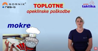 Opekline 2. del